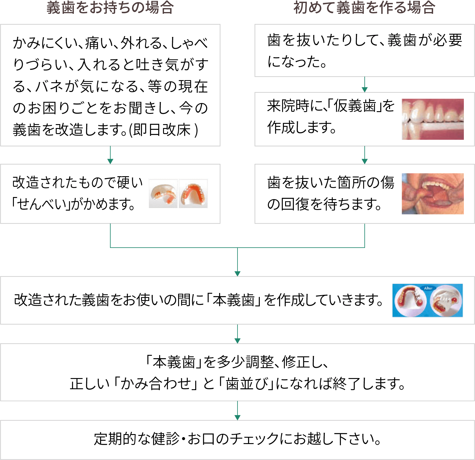 入れ歯治療の流れ図